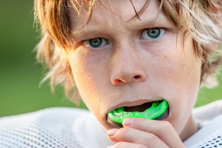 We are not kidding about mouthguards