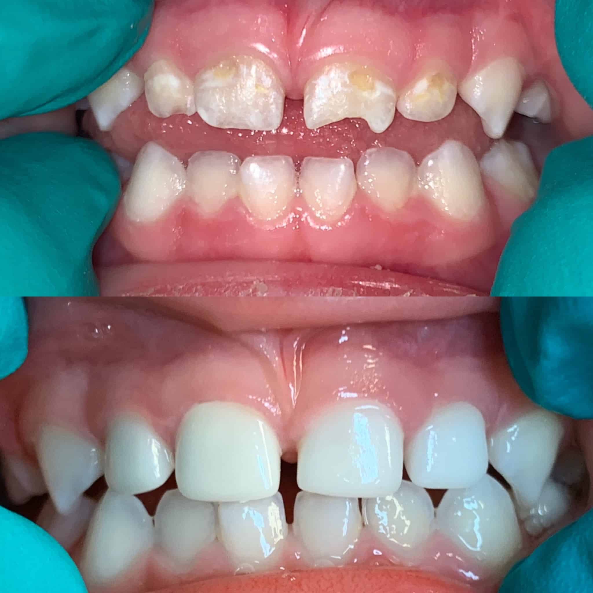 Teeth images
